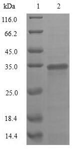 SDS-PAGE