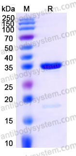 YHE96101, SDS-PAGE