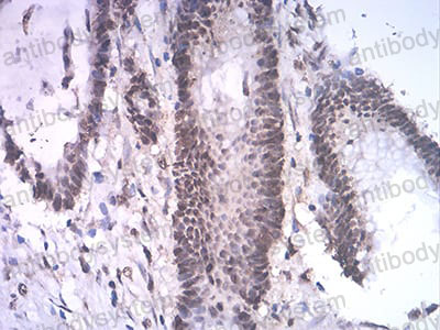 Валидация AntibodySystem RHK65803 (3712)