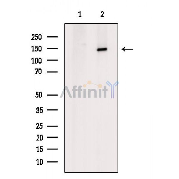 Валидация Affinity AF6878 - 4092