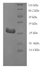 SDS-PAGE