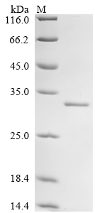SDS-PAGE