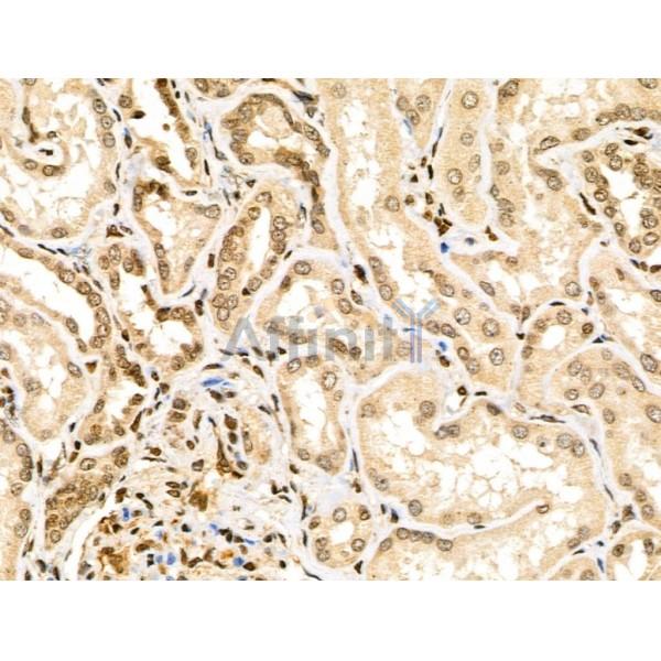 Валидация Affinity DF3622 - 14595