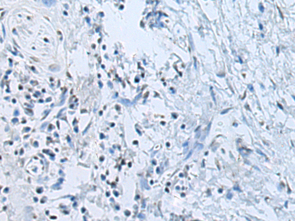 Валидация AssayVector ARM1882(2550)