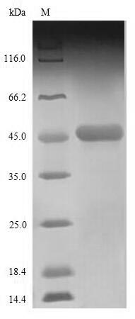 SDS-PAGE