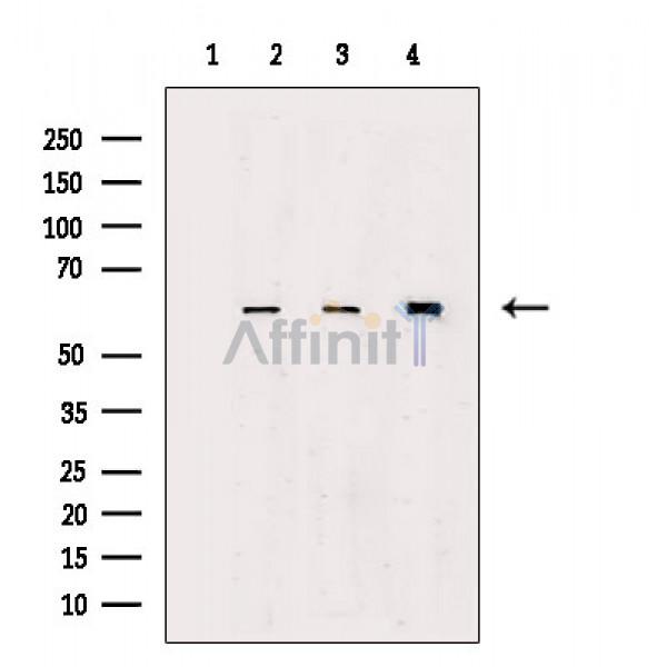 Валидация Affinity AF4048 - 2129