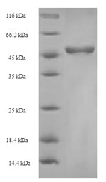 SDS-PAGE