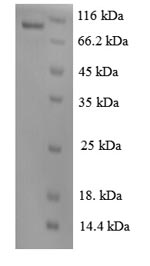 SDS-PAGE
