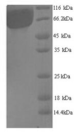 SDS-PAGE