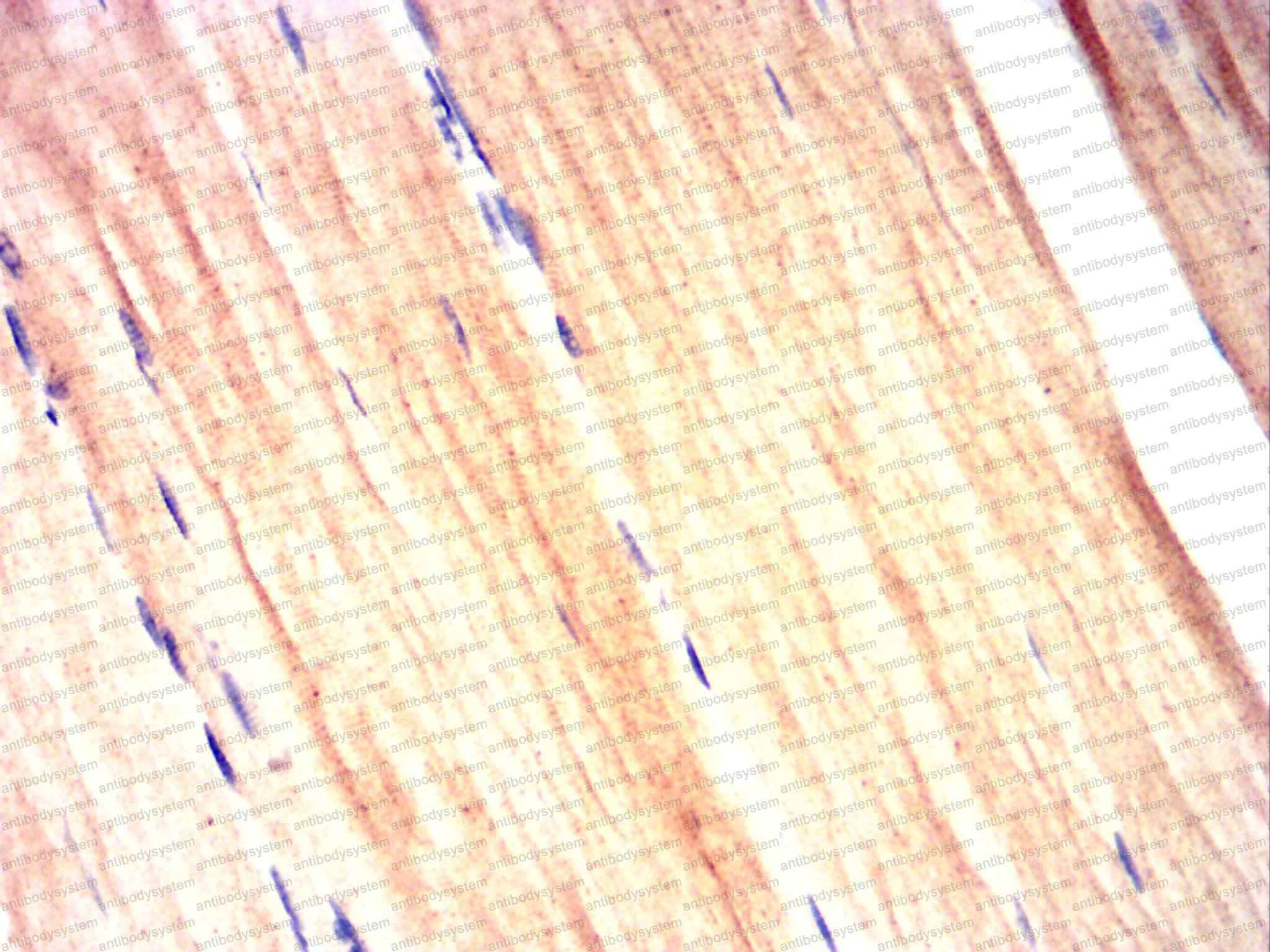 Валидация AntibodySystem RHJ82304