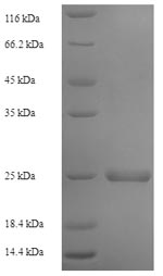 SDS-PAGE
