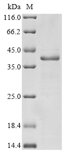 SDS-PAGE