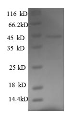 SDS-PAGE