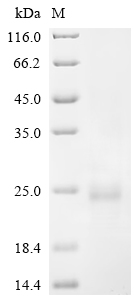 SDS-PAGE