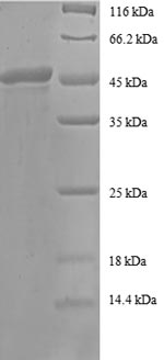 SDS-PAGE