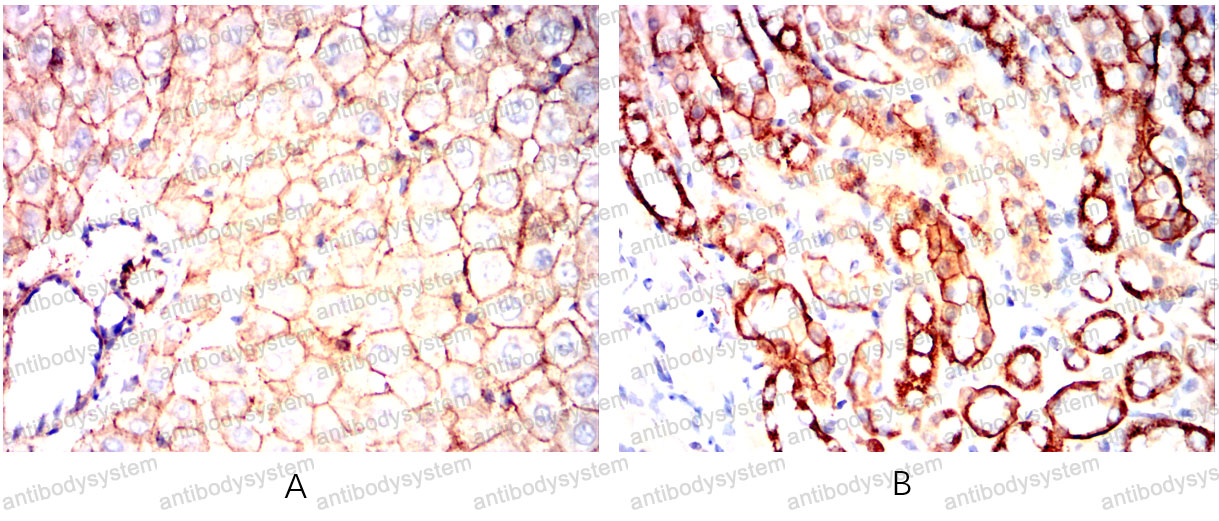 Валидация AntibodySystem RHD31902 (1485)