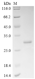 SDS-PAGE