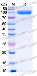 AHJ38904, SDS-PAGE