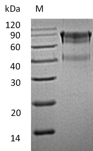 SDS-PAGE
