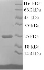 SDS-PAGE