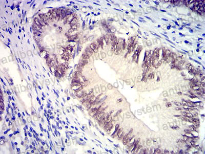 Валидация AntibodySystem RHK53203