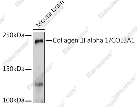 Вестерн-блоттинг, Collagen III alpha 1/COL3A1, мозг мыши