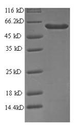SDS-PAGE
