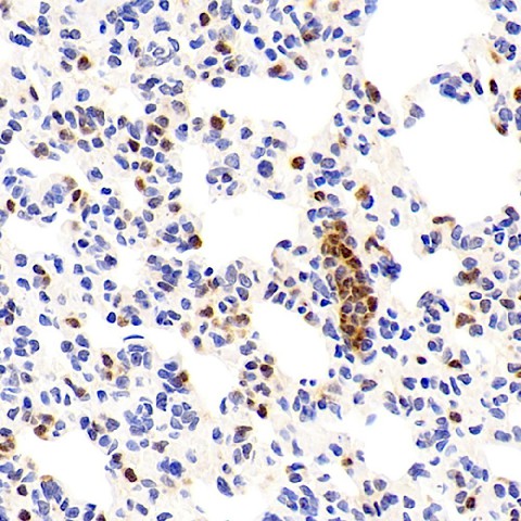 Валидация Elabscience E-AB-70257