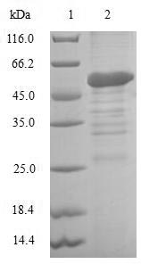 SDS-PAGE