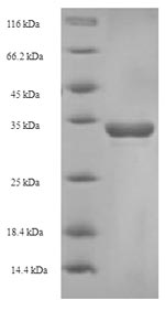 SDS-PAGE