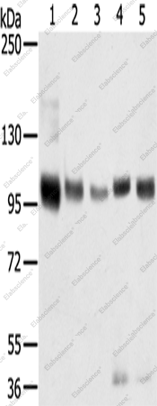Вестерн-блоттинг, SORT1, ткани мозга мыши и человека, простаты, жировой ткани и плаценты
