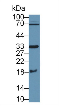 17689