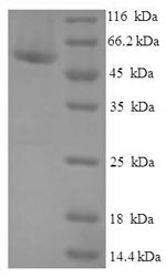 SDS-PAGE