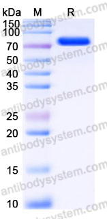 EHJ32502, SDS-PAGE
