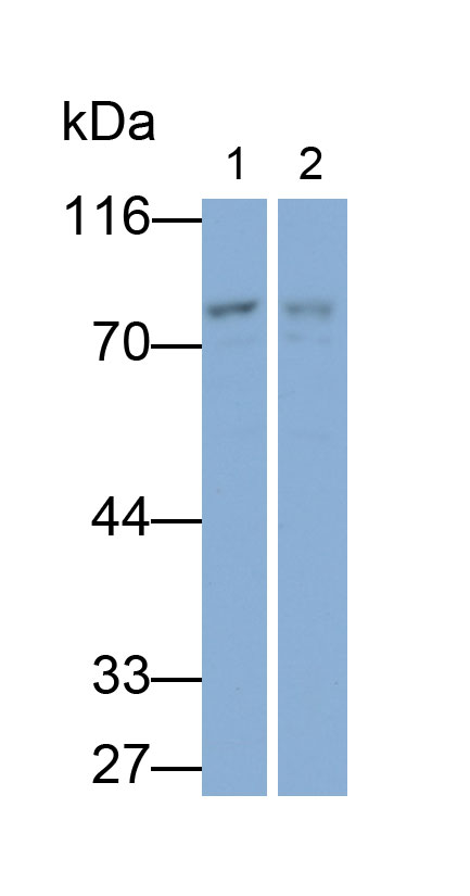 11155