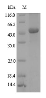 SDS-PAGE
