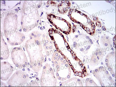 Валидация AntibodySystem RHE13401