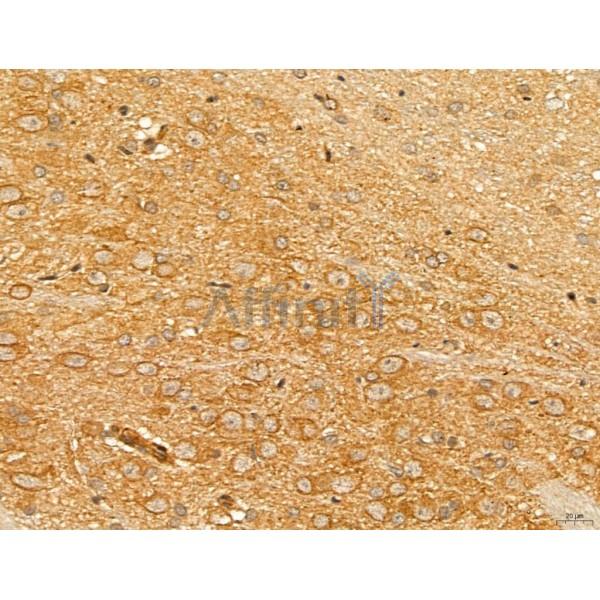 Валидация Affinity DF13122 - 8038