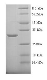 SDS-PAGE
