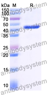 YZZ04201, SDS-PAGE