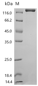 SDS-PAGE