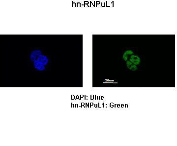 Валидация AssayVector ARM1840(2421)