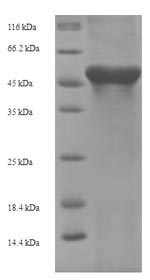 SDS-PAGE
