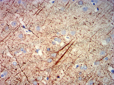 Валидация AntibodySystem RHC91704 (1182)