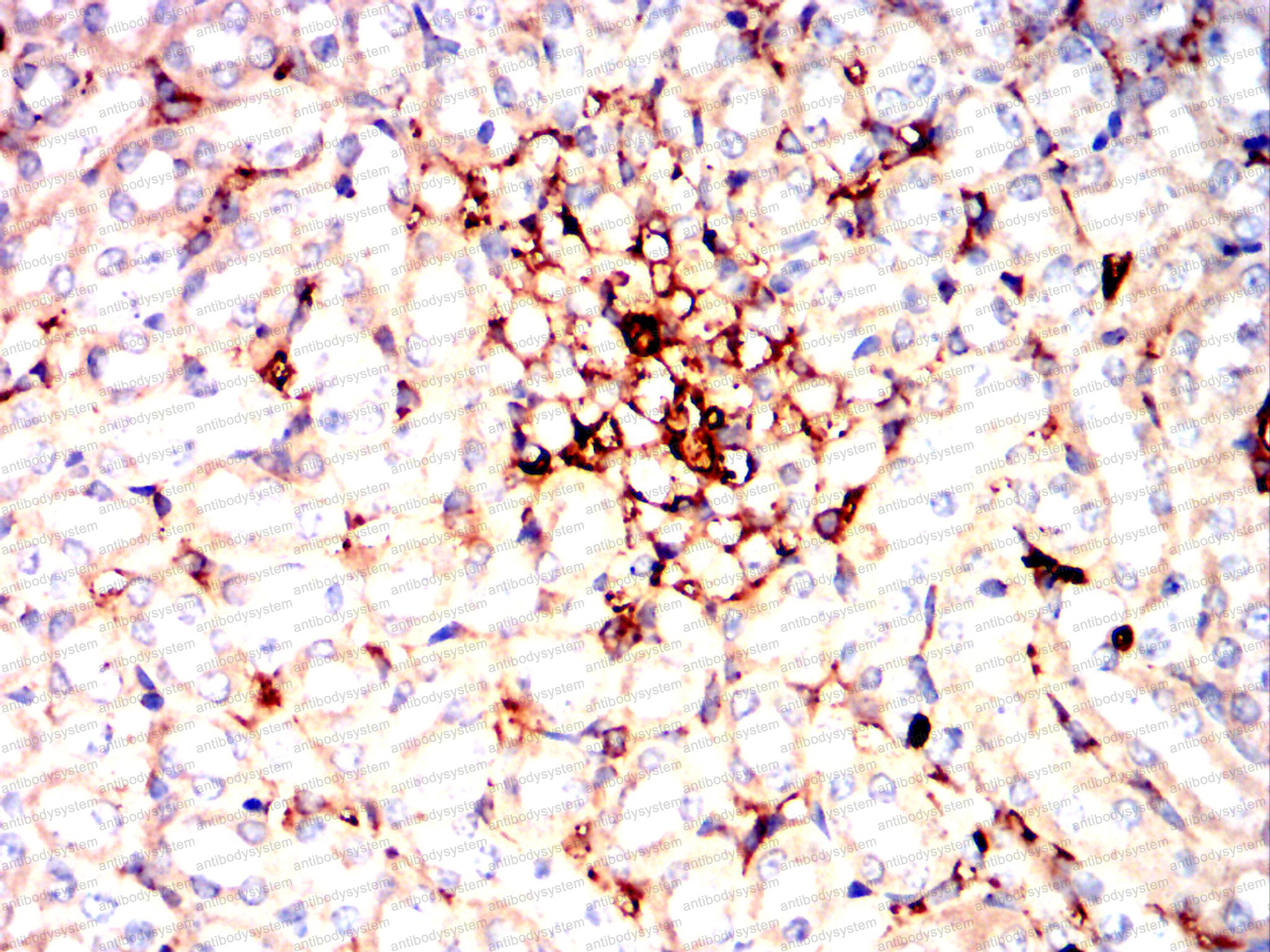 Валидация AntibodySystem RHE18301 (2019)