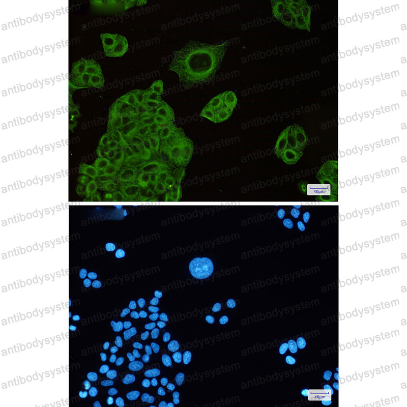Валидация IF - AntibodySystem RHC08901