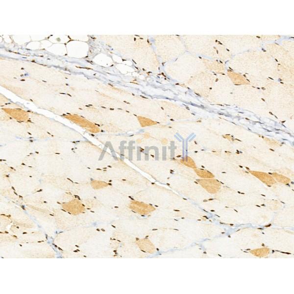 Валидация Affinity DF13178 - 8159