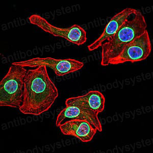 Валидация IF - AntibodySystem RHF98703 (1139)