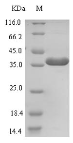 SDS-PAGE