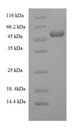 SDS-PAGE